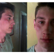 Photo of Luke Turner with his injuries. Photo of Luke Turner with his injuries.