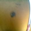A bite wound from her partner. Photo from Khanyisa. A bite wound from her partner. Photo from Khanyisa.