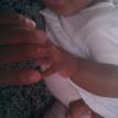 Child with rat bite on his finger. Child with rat bite on his finger.