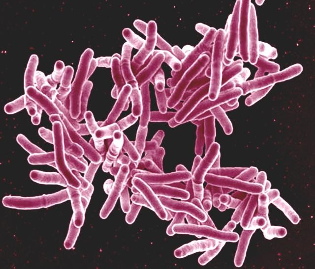 Image of TB bacterium