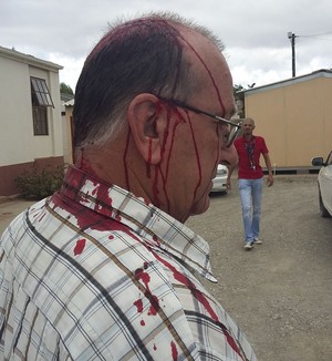 Photo of mayor bleeding from the head