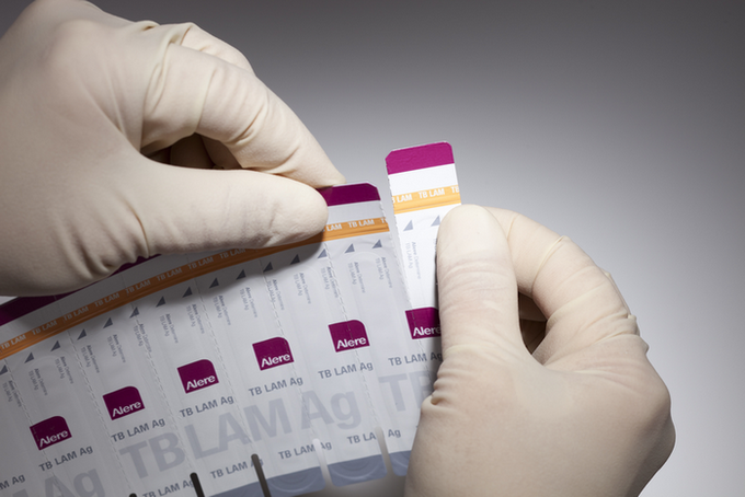 Photo of person holding TB lam test strips