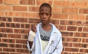 Photo of a young man holding up a bandaged hand