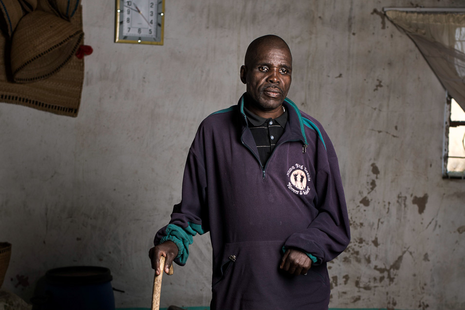 Myekelwa Mkenyane is a former miner who has silicosis. Photo by Thom Pierce.