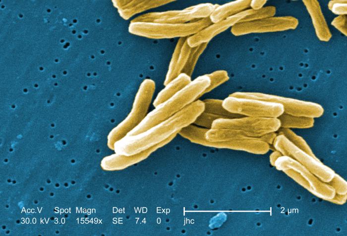 Image of tuberculosis bacteria